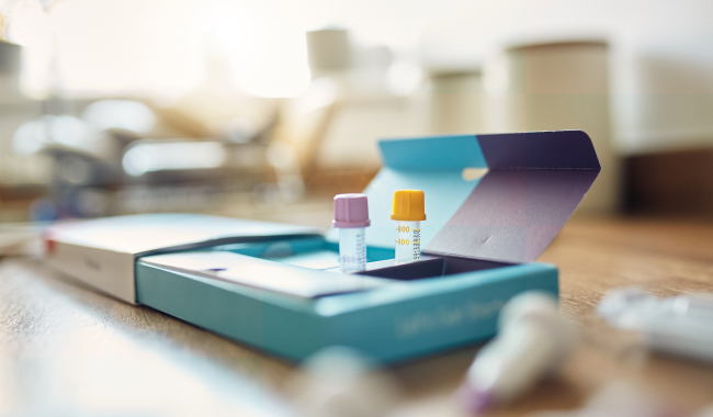 Open DNA test kit packaging with vials and instructions on a laboratory table